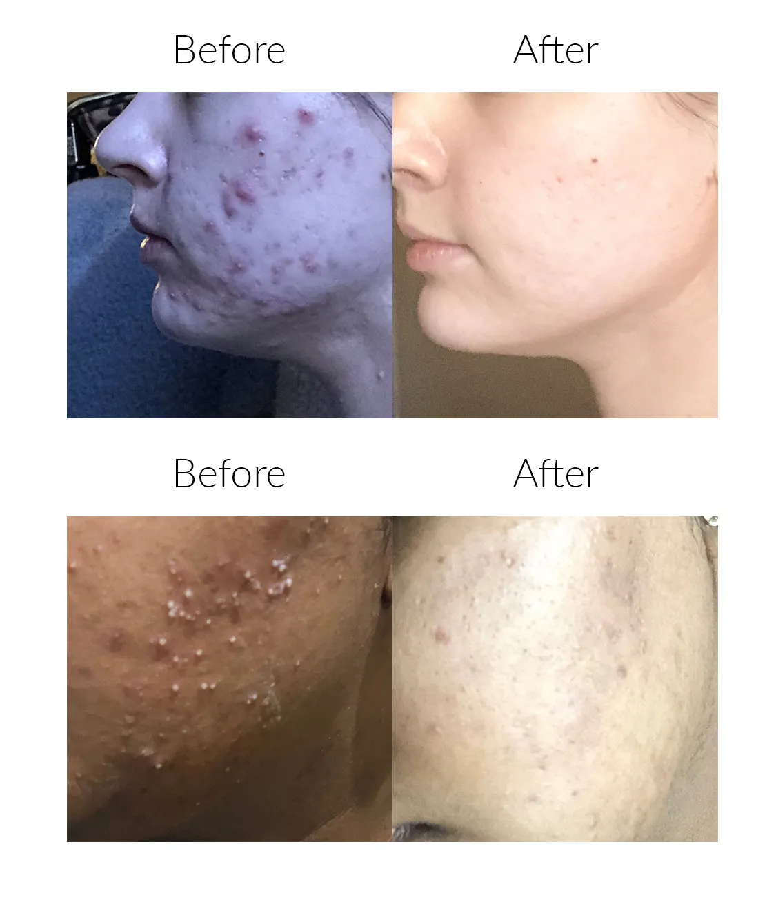 BrightenUp! Exfoliator   Glow Boosting Serum Kit