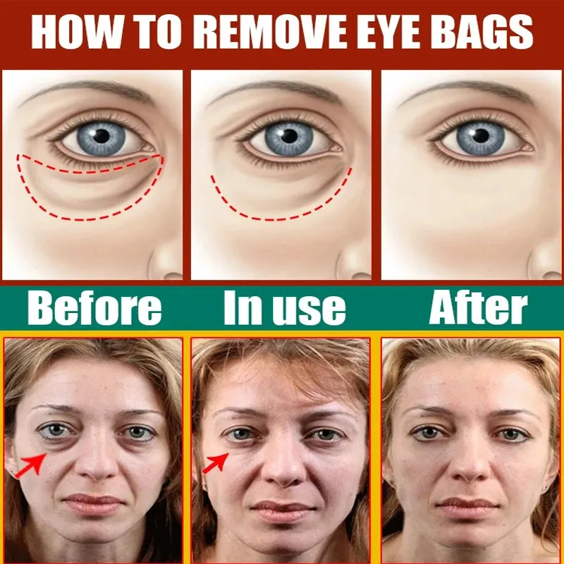 Eyes Bag Remove Collagen Eye Patch Instant Fade Fine Lines Dark Circles Fat Particles Moisturizing Anti-Puffiness Korea Eye Care