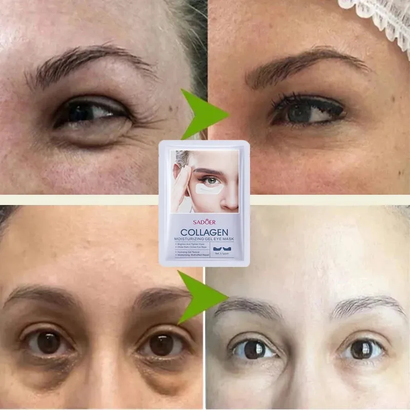 Eyes Bag Remove Collagen Eye Patch Instant Fade Fine Lines Dark Circles Fat Particles Moisturizing Anti-Puffiness Korea Eye Care